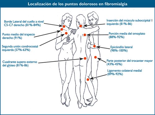 Las rotaciones del gantry del LINAC